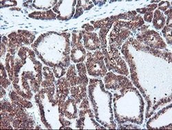 PSMB7 Monoclonal Antibody (OTI1D1), TrueMAB , OriGene 100 &mu;L; Unconjugated:Antibodies,
