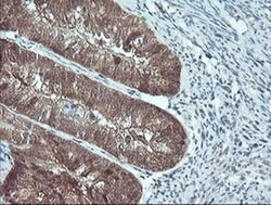 PSMB7 Monoclonal Antibody (OTI1D1), TrueMAB , OriGene 100 &mu;L; Unconjugated:Antibodies,