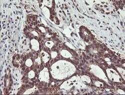 PSMB7 Monoclonal Antibody (OTI1D1), TrueMAB , OriGene 100 &mu;L; Unconjugated:Antibodies,