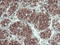 PSMB7 Monoclonal Antibody (OTI1D1), TrueMAB , OriGene:Antibodies:Primary