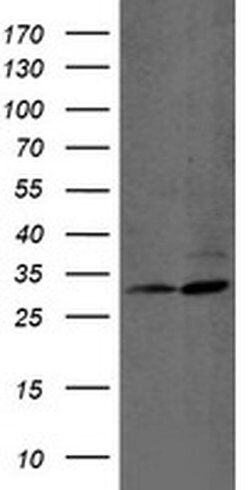 PSMB7 Monoclonal Antibody (OTI4E10), TrueMAB , OriGene:Antibodies:Primary