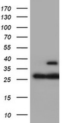 PSMB7 Monoclonal Antibody (OTI4G9), TrueMAB , OriGene 30 &mu;L; Unconjugated:Antibodies,