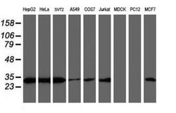 PSMB7 Monoclonal Antibody (OTI4G9), TrueMAB , OriGene:Antibodies:Primary