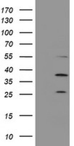 PSMB7 Monoclonal Antibody (OTI1D1), TrueMAB , OriGene 100 &mu;L; Unconjugated:Antibodies,