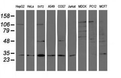 PSMB7 Monoclonal Antibody (OTI1D1), TrueMAB , OriGene 100 &mu;L; Unconjugated:Antibodies,