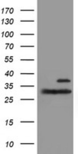 PSMB7 Mouse anti-Human, Mouse, Clone: OTI4D12, lyophilized, TrueMAB 100