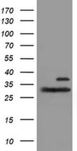 PSMB7 Monoclonal Antibody (OTI4D12), TrueMAB , OriGene 30 &mu;L; Unconjugated:Antibodies,