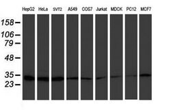 PSMB7 Mouse anti-Human, Mouse, Clone: OTI4D12, lyophilized, TrueMAB 100