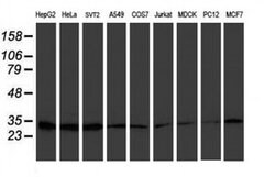 PSMB7 Monoclonal Antibody (OTI4D12), TrueMAB , OriGene 30 &mu;L; Unconjugated:Antibodies,