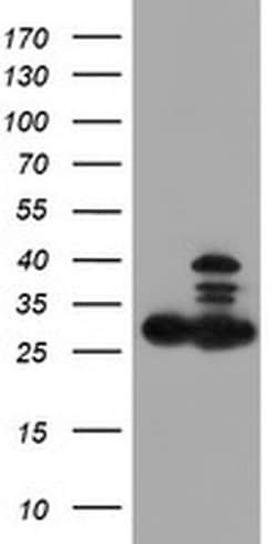 PSMB7 Monoclonal Antibody (OTI4E3), TrueMAB , OriGene 30 &mu;L; Unconjugated:Antibodies,