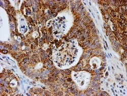 PSMB9 Mouse anti-Human, Clone: OTI1G7, lyophilized, TrueMAB 100 &mu;g;