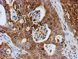 PSMB9 Monoclonal Antibody (OTI1G7), TrueMAB , OriGene 30 &mu;L; Unconjugated:Antibodies,