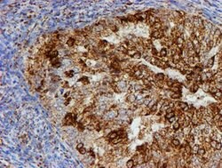 PSMB9 Mouse anti-Human, Clone: OTI1G7, lyophilized, TrueMAB 100 &mu;g;