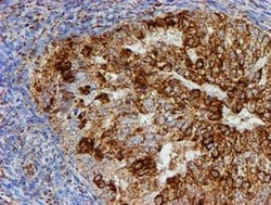 PSMB9 Monoclonal Antibody (OTI1G7), TrueMAB , OriGene 30 &mu;L; Unconjugated:Antibodies,