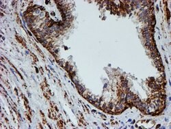 PSMB9 Mouse anti-Human, Clone: OTI1G7, lyophilized, TrueMAB 100 &mu;g;