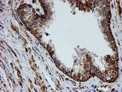 PSMB9 Monoclonal Antibody (OTI1G7), TrueMAB , OriGene 30 &mu;L; Unconjugated:Antibodies,