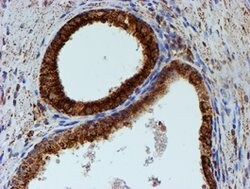 PSMB9 Mouse anti-Human, Clone: OTI1G7, lyophilized, TrueMAB 100 &mu;g;