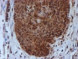 PSMB9 Mouse anti-Human, Clone: OTI1G7, lyophilized, TrueMAB 100 &mu;g;