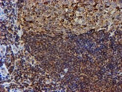 PSMB9 Mouse anti-Human, Clone: OTI1G7, lyophilized, TrueMAB 100 &mu;g;
