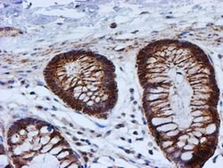 PSMB9 Mouse anti-Human, Clone: OTI1G7, lyophilized, TrueMAB 100 &mu;g;