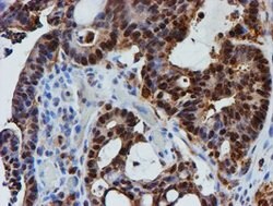 PSMB9 Mouse anti-Human, Clone: OTI1G7, lyophilized, TrueMAB 100 &mu;g;