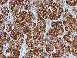 PSMB9 Mouse anti-Human, Clone: OTI1G7, lyophilized, TrueMAB 100 &mu;g;