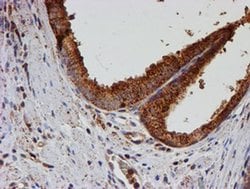 PSMB9 Monoclonal Antibody (OTI3H1), TrueMAB , OriGene 30 &mu;L; Unconjugated:Antibodies,