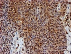 PSMB9 Monoclonal Antibody (OTI3H1), TrueMAB , OriGene 30 &mu;L; Unconjugated:Antibodies,