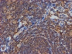 PSMB9 Monoclonal Antibody (OTI3H1), TrueMAB , OriGene 30 &mu;L; Unconjugated:Antibodies,