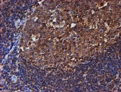 PSMB9 Monoclonal Antibody (OTI3H1), TrueMAB , OriGene 30 &mu;L; Unconjugated:Antibodies,
