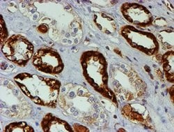 PSMB9 Monoclonal Antibody (OTI3H1), TrueMAB , OriGene 30 &mu;L; Unconjugated:Antibodies,