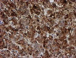 PSMB9 Monoclonal Antibody (OTI3H1), TrueMAB , OriGene 30 &mu;L; Unconjugated:Antibodies,