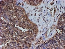 PSMB9 Monoclonal Antibody (OTI3F3), TrueMAB , OriGene 100 &mu;L; Unconjugated:Antibodies,