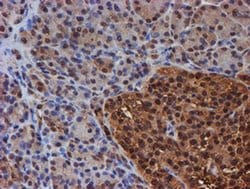 PSMB9 Monoclonal Antibody (OTI3F3), TrueMAB , OriGene 100 &mu;L; Unconjugated:Antibodies,