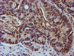 PSMB9 Monoclonal Antibody (OTI3F3), TrueMAB , OriGene 100 &mu;L; Unconjugated:Antibodies,