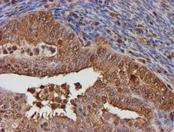 PSMB9 Monoclonal Antibody (OTI3F3), TrueMAB , OriGene 100 &mu;L; Unconjugated:Antibodies,