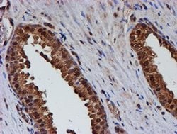 PSMB9 Monoclonal Antibody (OTI3F3), TrueMAB , OriGene 100 &mu;L; Unconjugated:Antibodies,