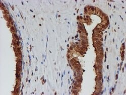 PSMB9 Monoclonal Antibody (OTI3F3), TrueMAB , OriGene 100 &mu;L; Unconjugated:Antibodies,