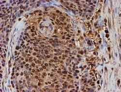 PSMB9 Monoclonal Antibody (OTI3F3), TrueMAB , OriGene 100 &mu;L; Unconjugated:Antibodies,
