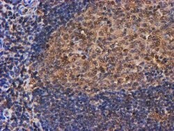 PSMB9 Monoclonal Antibody (OTI3F3), TrueMAB , OriGene 100 &mu;L; Unconjugated:Antibodies,