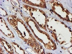 PSMB9 Monoclonal Antibody (OTI3F3), TrueMAB , OriGene 100 &mu;L; Unconjugated:Antibodies,