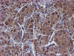 PSMB9 Monoclonal Antibody (OTI3F3), TrueMAB , OriGene 100 &mu;L; Unconjugated:Antibodies,