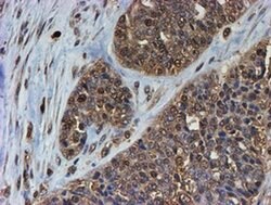 PSMB9 Monoclonal Antibody (OTI2G6), TrueMAB , OriGene 100 &mu;L; Unconjugated:Antibodies,