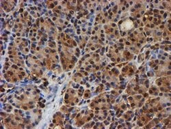 PSMB9 Monoclonal Antibody (OTI2G6), TrueMAB , OriGene 100 &mu;L; Unconjugated:Antibodies,
