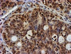 PSMB9 Monoclonal Antibody (OTI2G6), TrueMAB , OriGene 100 &mu;L; Unconjugated:Antibodies,