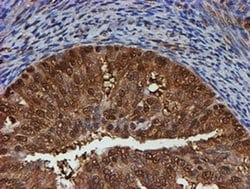 PSMB9 Monoclonal Antibody (OTI2G6), TrueMAB , OriGene 100 &mu;L; Unconjugated:Antibodies,