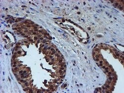 PSMB9 Monoclonal Antibody (OTI2G6), TrueMAB , OriGene 100 &mu;L; Unconjugated:Antibodies,