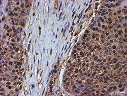 PSMB9 Monoclonal Antibody (OTI2G6), TrueMAB , OriGene 100 &mu;L; Unconjugated:Antibodies,