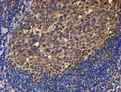 PSMB9 Monoclonal Antibody (OTI2G6), TrueMAB , OriGene 100 &mu;L; Unconjugated:Antibodies,