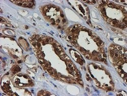 PSMB9 Monoclonal Antibody (OTI2G6), TrueMAB , OriGene 100 &mu;L; Unconjugated:Antibodies,
